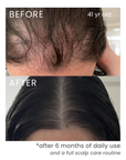 Scalp Hair Essence (Promotes Hair Growth)