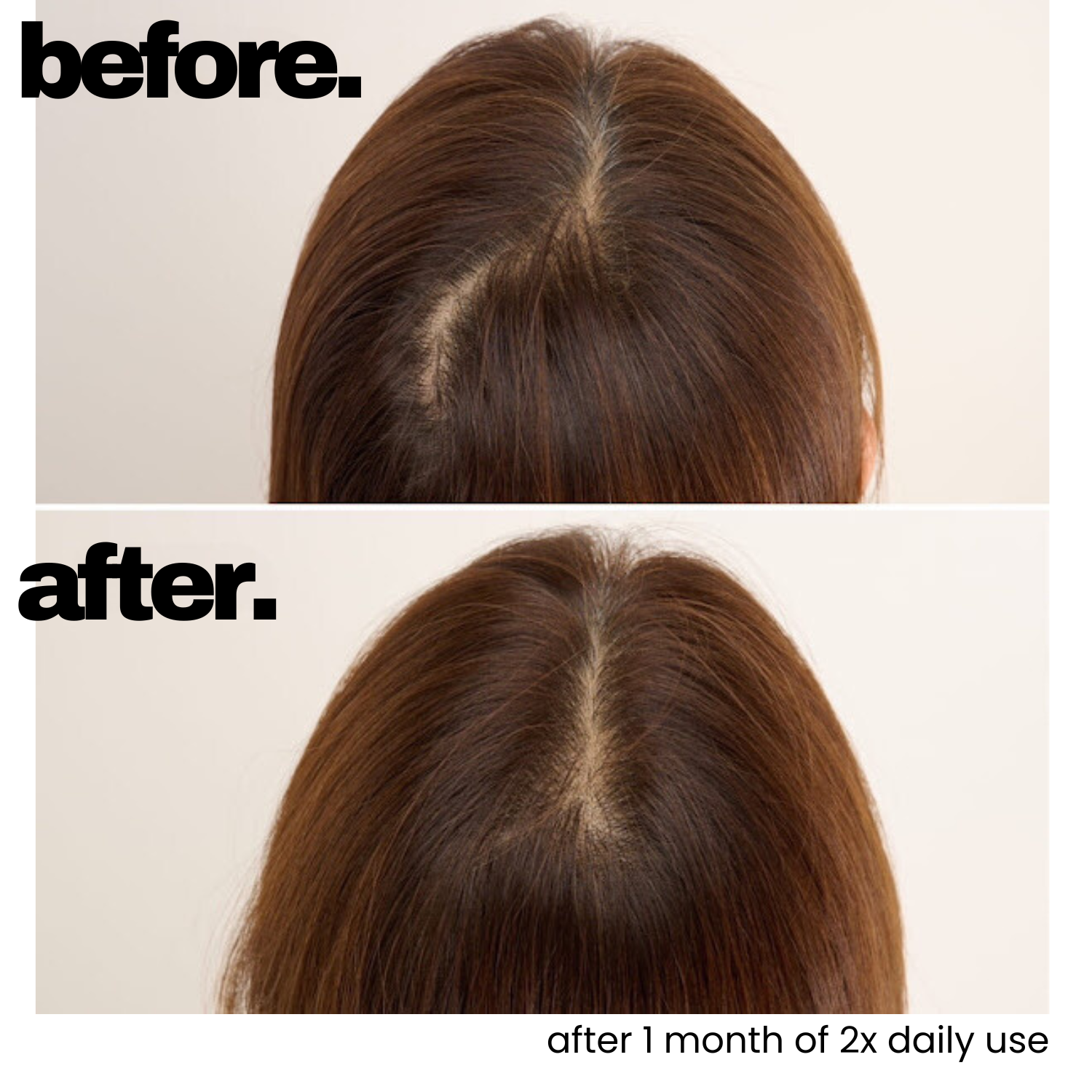 Scalp Hair Essence (Promotes Hair Growth)
