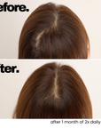 Scalp Hair Essence (Promotes Hair Growth)