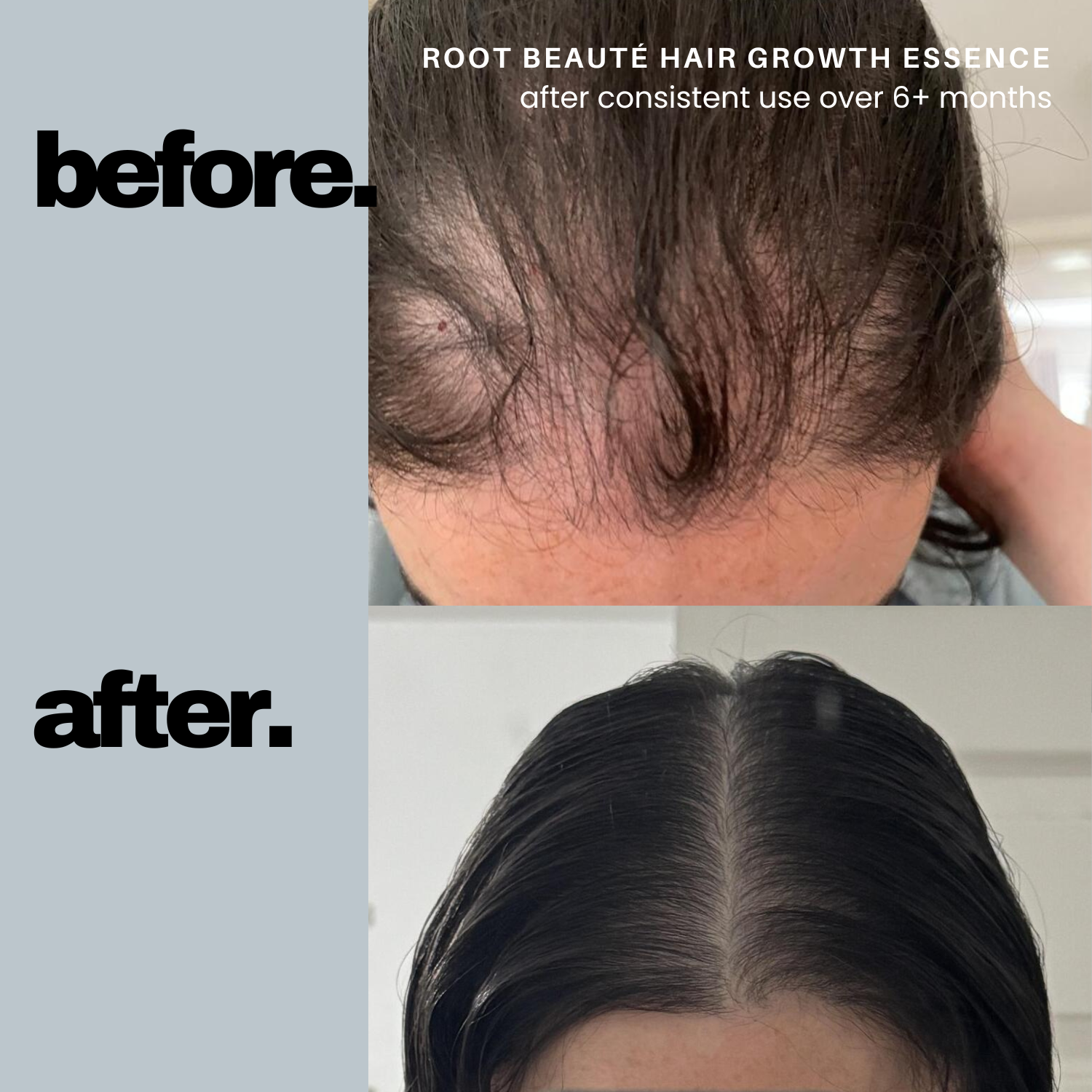 Scalp Massage Hair Essence (Promotes Hair Growth)