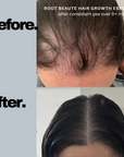 Scalp Massage Hair Essence (Promotes Hair Growth)